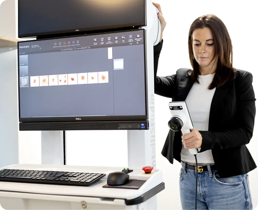 DermaSkan: Tryg og professionel vurdering af modermærker